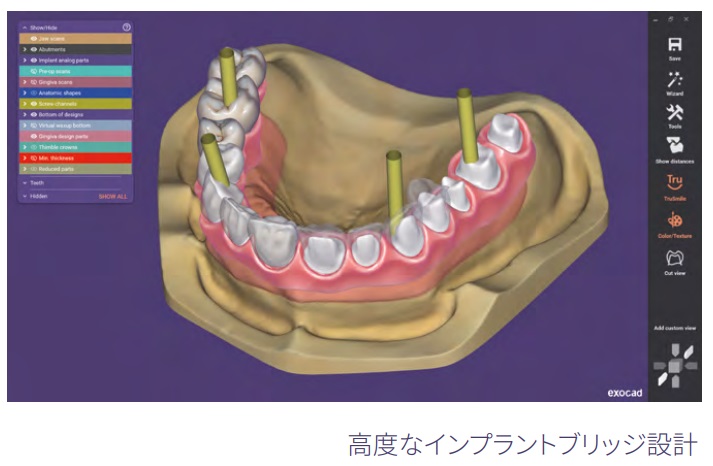100％デジタル治療