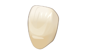 前歯部セラミック